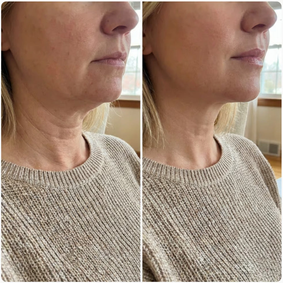 Alloras V-Lifting Mewing Band