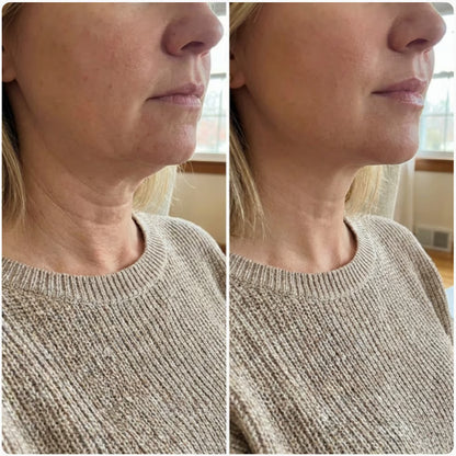 Alloras V-Lifting Mewing Band