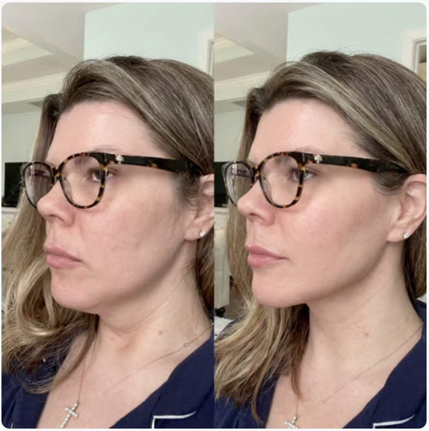 Alloras V-Lifting Mewing Band